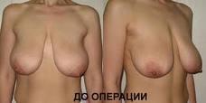 untitled11111111111111.JPG